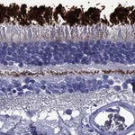 Atlas Antibodies Anti-ROM1 Antibody