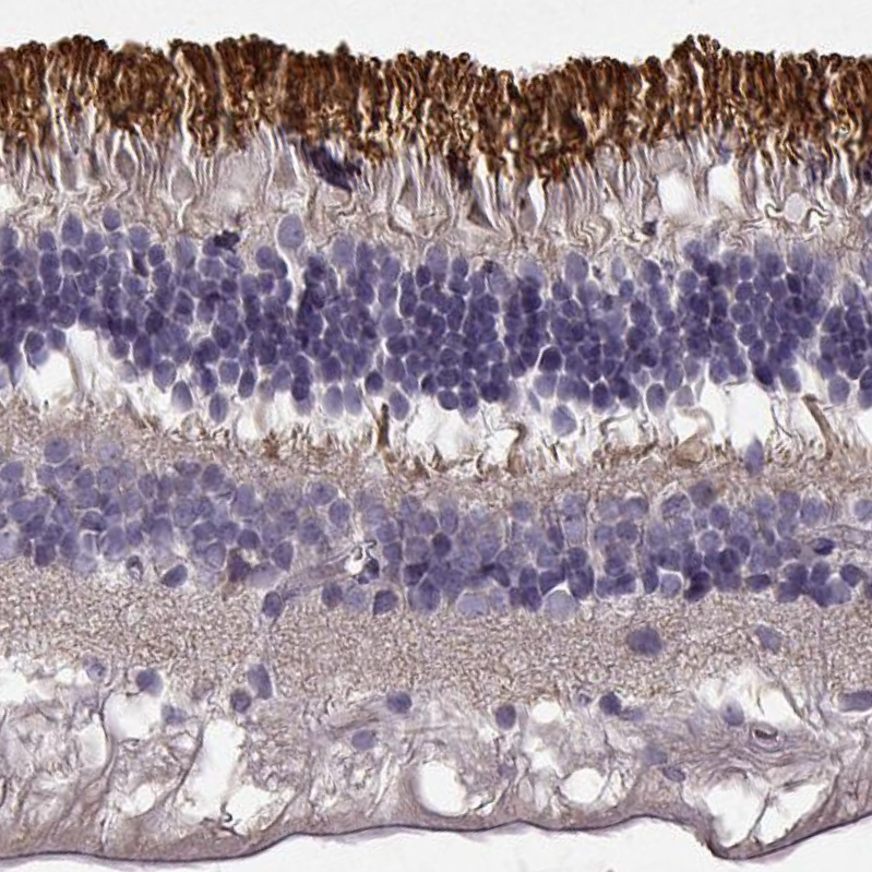 Atlas Antibodies Anti-ROM1 Antibody