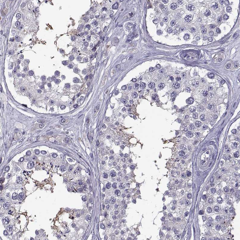 Atlas Antibodies Anti-ROPN1B Antibody