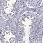 Atlas Antibodies Anti-ROPN1B Antibody