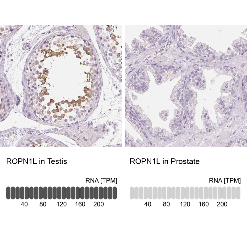 Atlas Antibodies Anti-ROPN1L Antibody