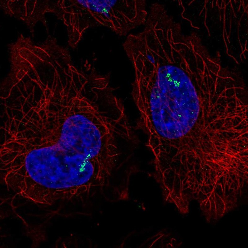 Atlas Antibodies Anti-RORC Antibody