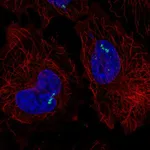 Atlas Antibodies Anti-RORC Antibody