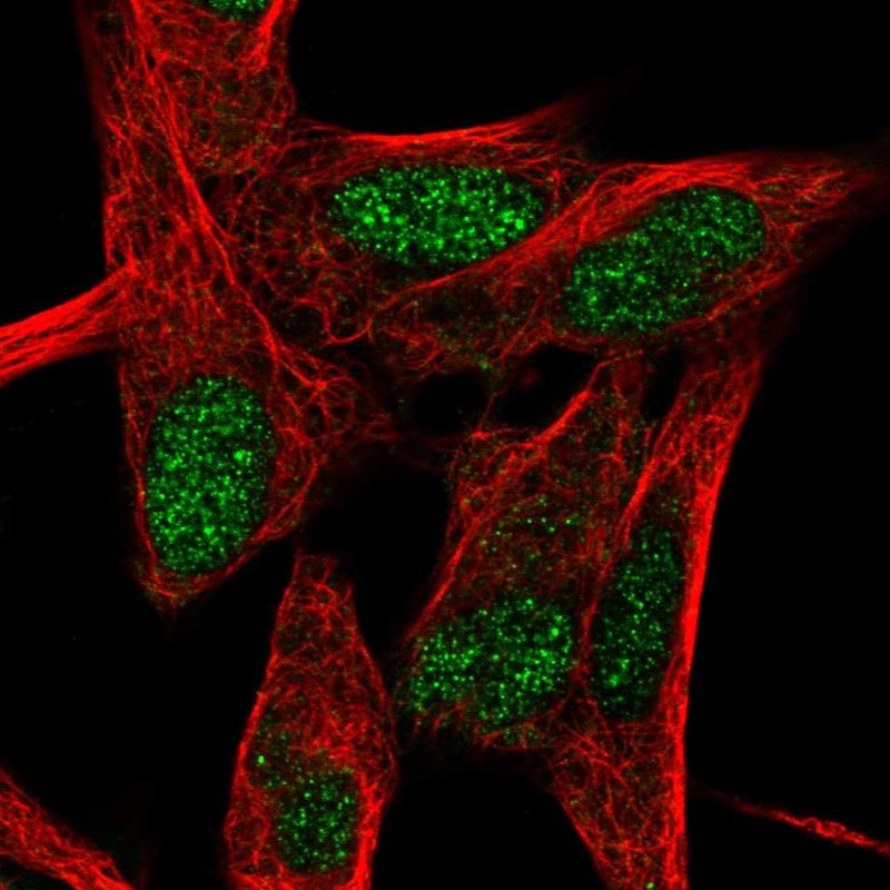 Atlas Antibodies Anti-RORB Antibody