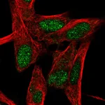 Atlas Antibodies Anti-RORB Antibody