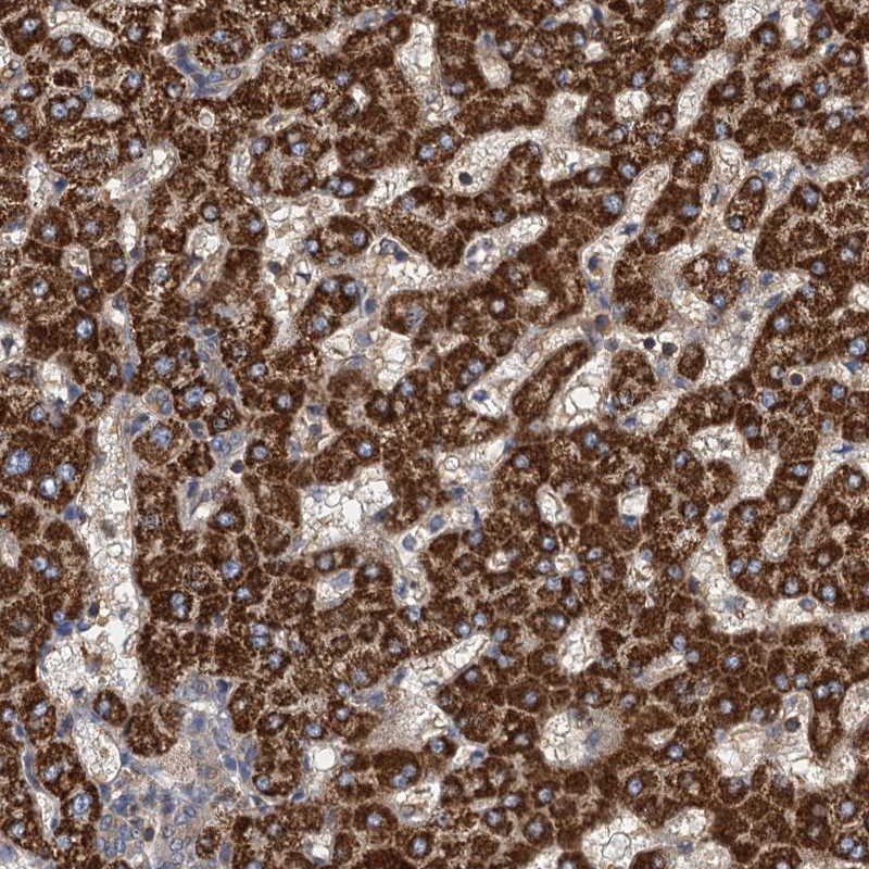 Atlas Antibodies Anti-ROGDI Antibody