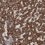 Atlas Antibodies Anti-ROGDI Antibody
