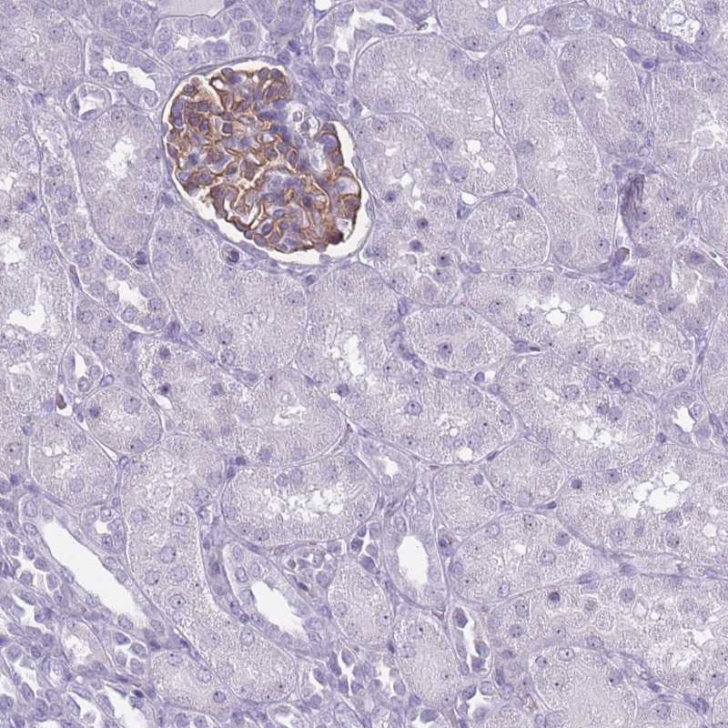 Atlas Antibodies Anti-ROS1 Antibody