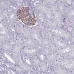 Atlas Antibodies Anti-ROS1 Antibody