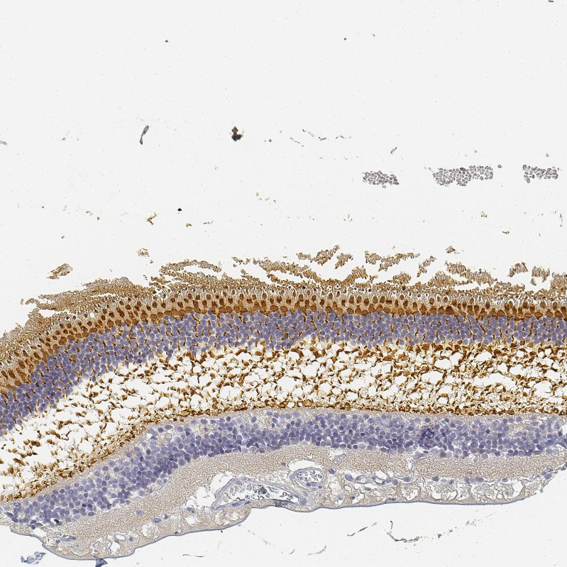 Atlas Antibodies Anti-RP1 Antibody