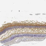 Atlas Antibodies Anti-RP1 Antibody