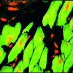 Merck MONOCLONAL ANTI-TROPONIN T, CLONE JLT-12