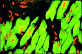 Merck MONOCLONAL ANTI-TROPONIN T, CLONE JLT-12