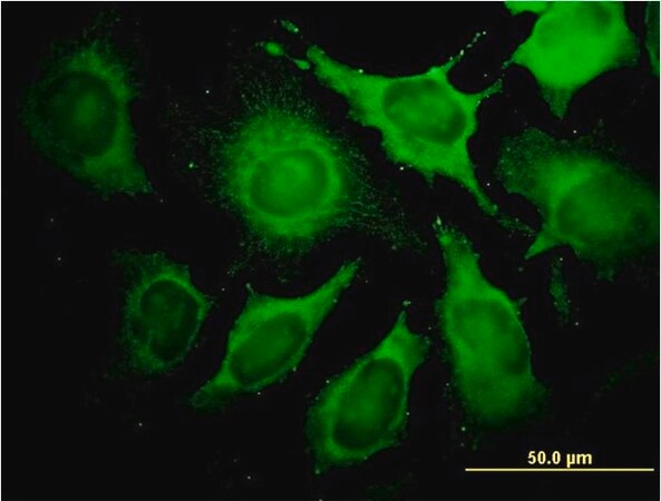Merck Monoclonal Anti-ALDOA antibody produced in mouse
