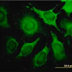 Merck Monoclonal Anti-ALDOA antibody produced in mouse
