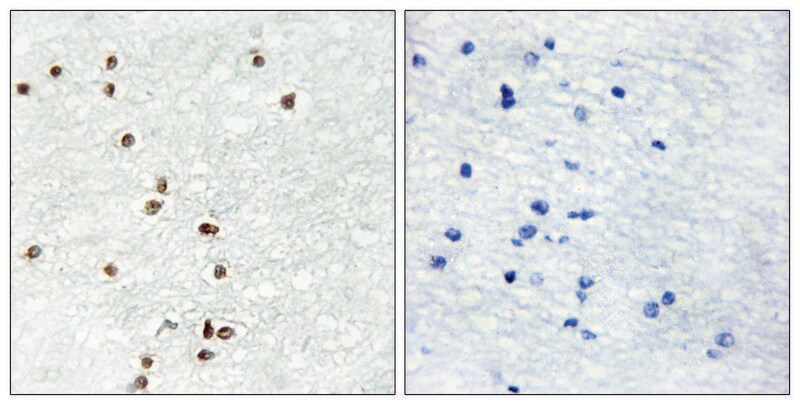 Merck Anti-ZIC1 antibody produced in rabbit