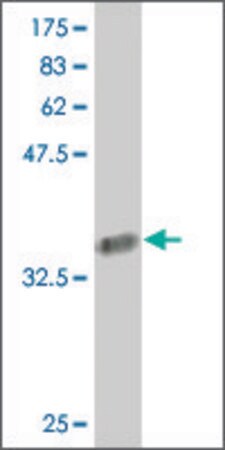 Merck Monoclonal Anti-COL24A1 antibody produced in mouse