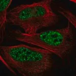 Merck Anti-ZFAND6 antibody produced in rabbit