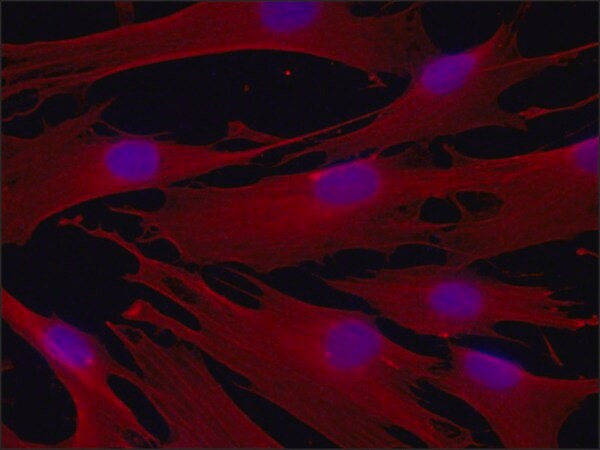 Merck Anti-beta-Tubulin IV antibody, Mouse monoclonal