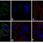 Thermo Fisher Scientific Goat anti-Mouse IgG (H+L) Secondary Antibody, Alexa Fluor 488-10 nm colloidal gold