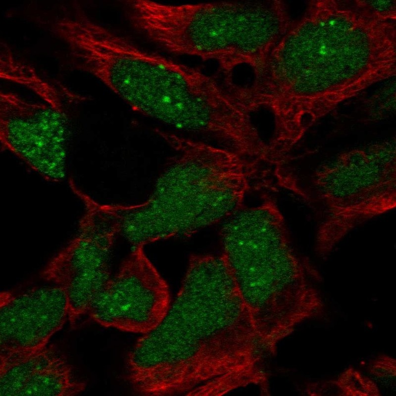 Atlas Antibodies Anti-RP11-302B13.5 Antibody