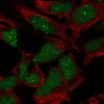 Atlas Antibodies Anti-RP11-302B13.5 Antibody