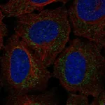 Atlas Antibodies Anti-RP11-80H18.3 Antibody