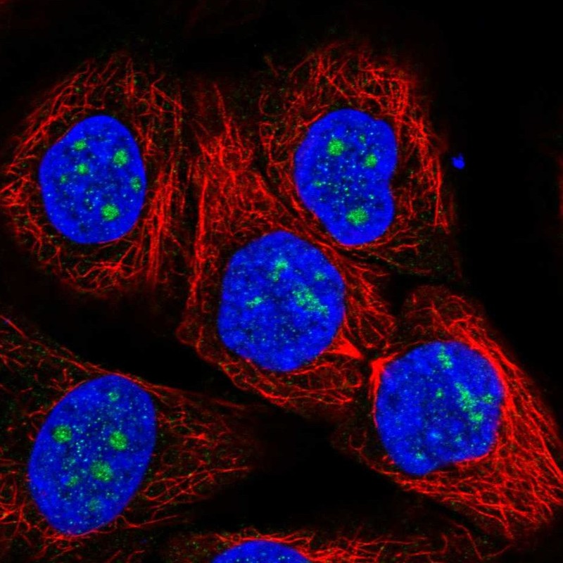 Atlas Antibodies Anti-RP11-849H4.2 Antibody