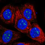 Atlas Antibodies Anti-RP11-849H4.2 Antibody