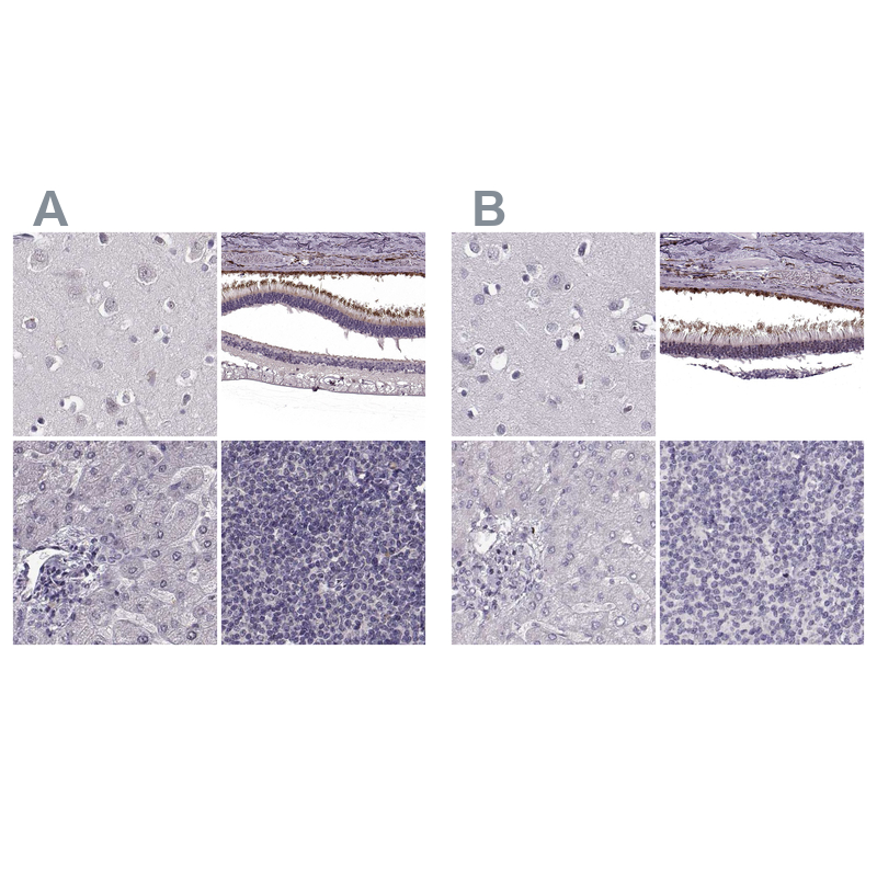 Atlas Antibodies Anti-RP1L1 Antibody