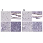 Atlas Antibodies Anti-RP1L1 Antibody