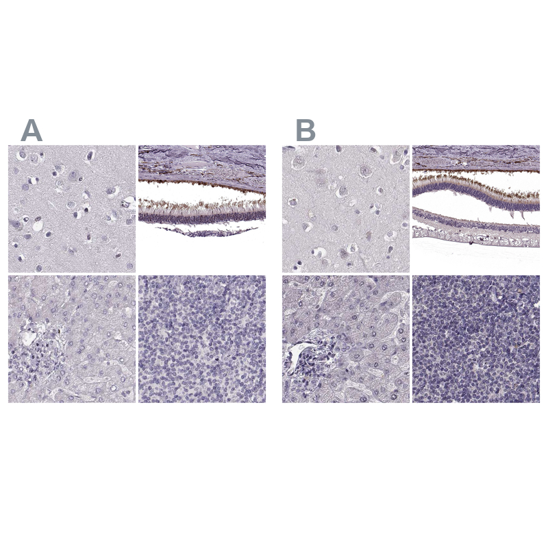 Atlas Antibodies Anti-RP1L1 Antibody