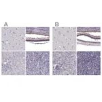 Atlas Antibodies Anti-RP1L1 Antibody