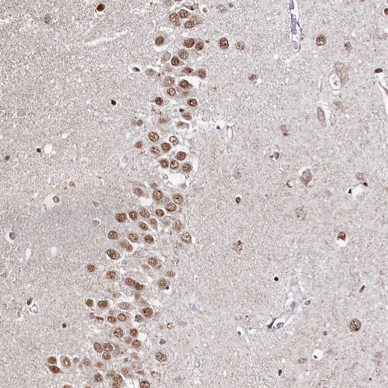 Atlas Antibodies Anti-RP11-382A20.3 Antibody