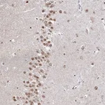 Atlas Antibodies Anti-RP11-382A20.3 Antibody
