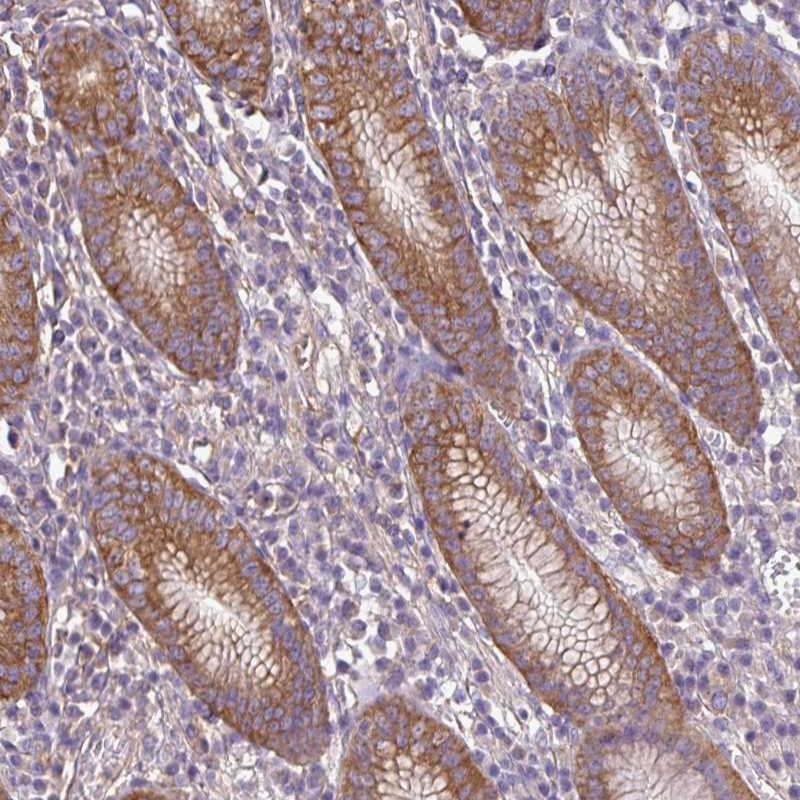 Atlas Antibodies Anti-RP11-849H4.2 Antibody