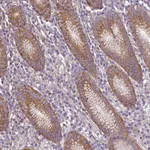 Atlas Antibodies Anti-RP11-849H4.2 Antibody
