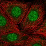 Atlas Antibodies Anti-RP9 Antibody