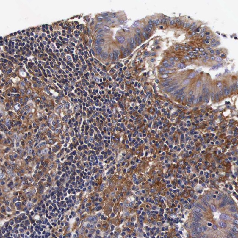 Atlas Antibodies Anti-RP2 Antibody