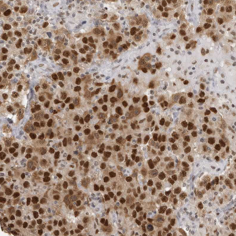 Atlas Antibodies Anti-RPA2 Antibody