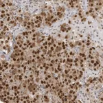 Atlas Antibodies Anti-RPA2 Antibody