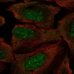 Atlas Antibodies Anti-RP2 Antibody