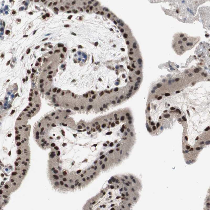 Atlas Antibodies Anti-RPA1 Antibody
