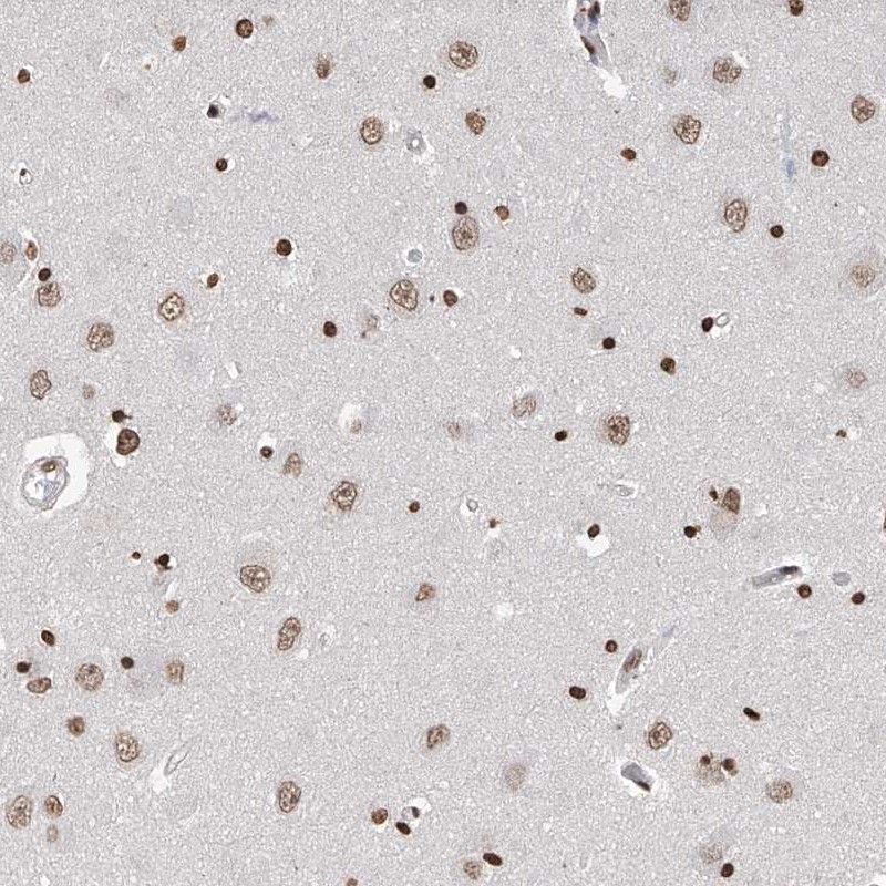 Atlas Antibodies Anti-RP9 Antibody