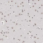 Atlas Antibodies Anti-RP9 Antibody