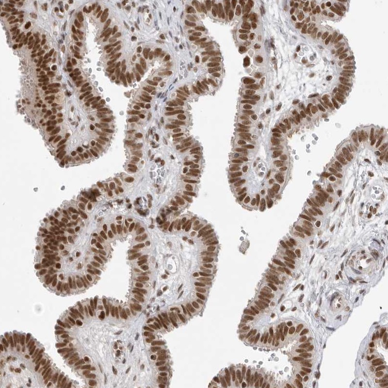 Atlas Antibodies Anti-RPA2 Antibody