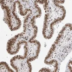 Atlas Antibodies Anti-RPA2 Antibody
