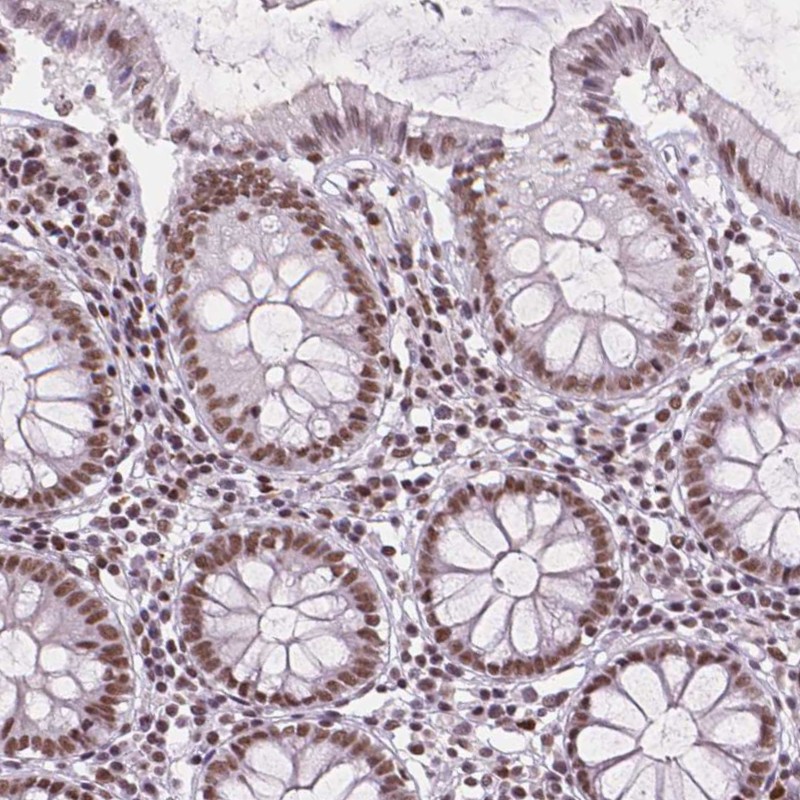 Atlas Antibodies Anti-RPA4 Antibody