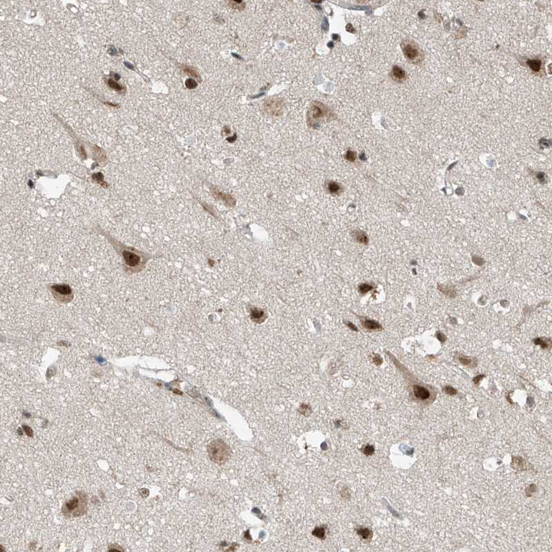 Atlas Antibodies Anti-RPAIN Antibody