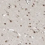 Atlas Antibodies Anti-RPAIN Antibody